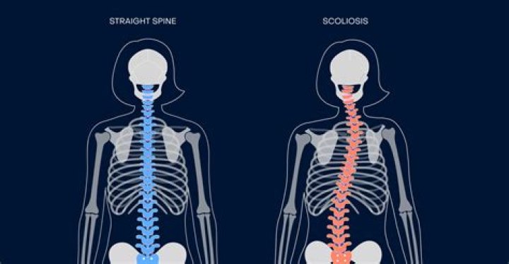 Ellen Pompeo's Journey with Scoliosis: A Story of Strength