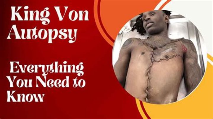 Unraveling the Mystery Behind King Von's Autopsy Photo