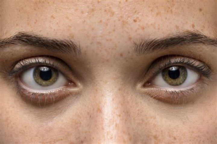 Unveiling the Mystery of Sanpaku Eyes: More Than Just a Physical Trait